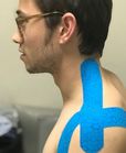 Shoulder Injury Rehabilitation